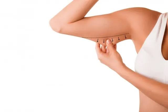 How To Know if Liposuction Is Right for You