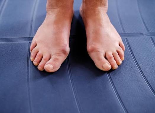 Recovery Tips After Foot and Ankle Surgery