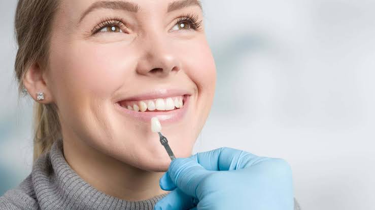 FAQs About Cosmetic Dentistry